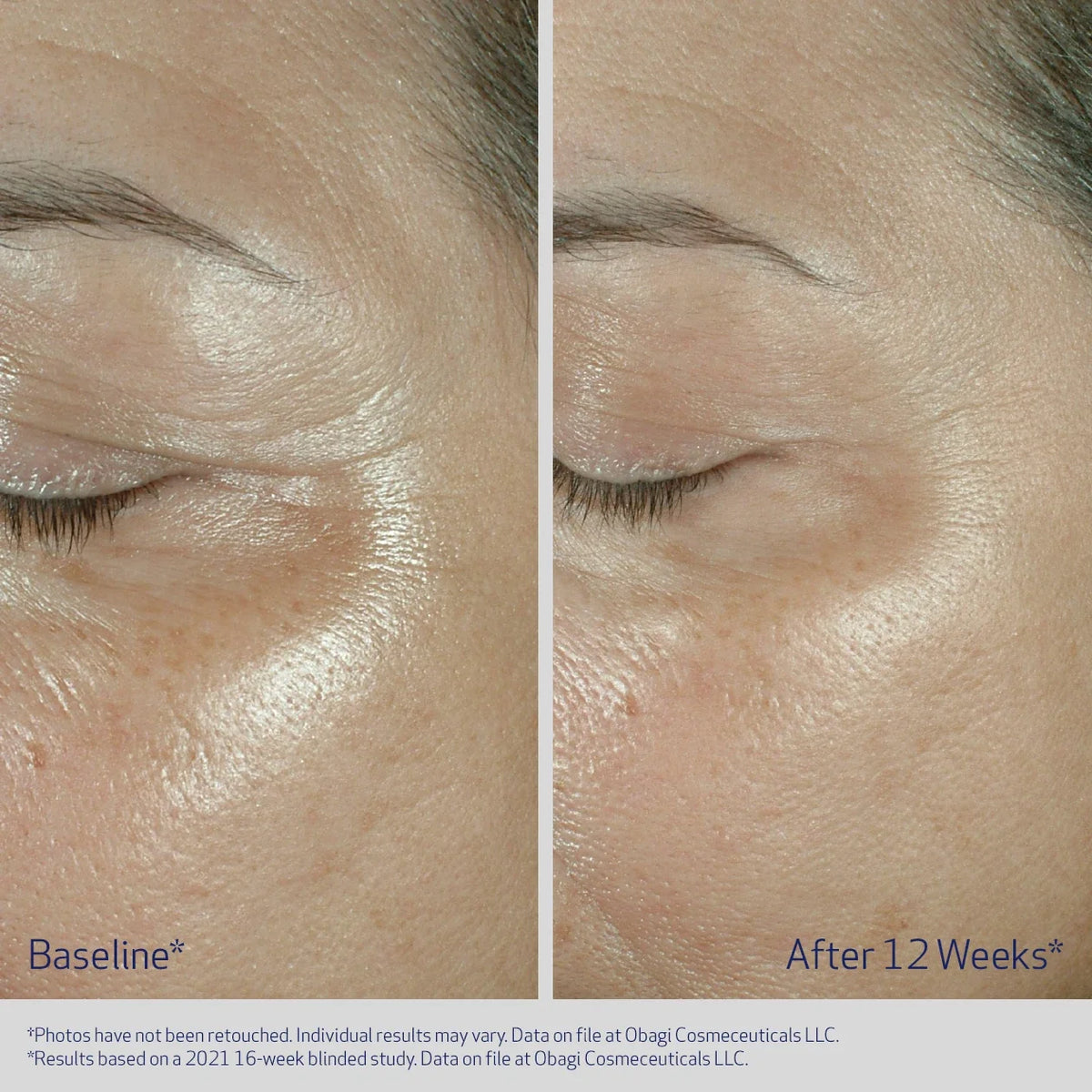 Obagi® Medical ELASTIDERM® Firming Eye Cream
