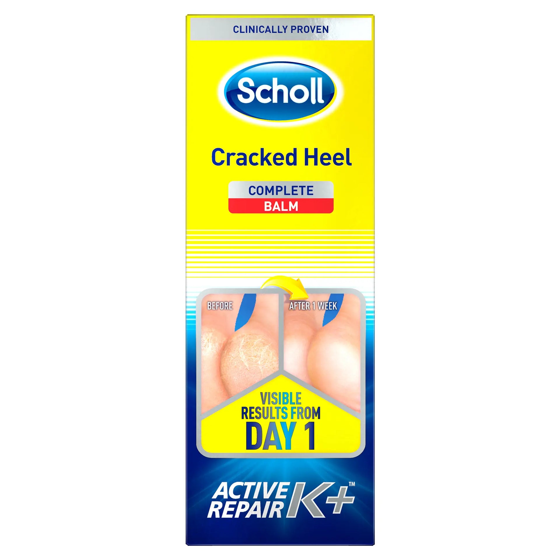 Dr. Scholl's Cracked Heel Repair Balm: Active Repair K+